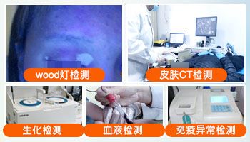 心理干预-女性白癜风患者如何调节情绪-